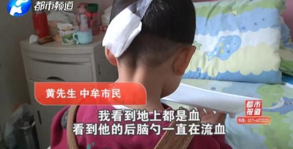 火影忍者拼图困难（玩具成凶器1岁孩子头颅被刺穿这些伤人玩具你家可能也有）