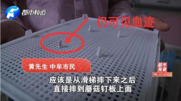 玩具成凶器！1岁孩子头颅被刺穿！这些伤人玩具你家可能也有