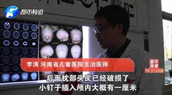 玩具成凶器！1岁孩子头颅被刺穿！这些伤人玩具你家可能也有