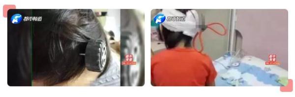 玩具成凶器！1岁孩子头颅被刺穿！这些伤人玩具你家可能也有