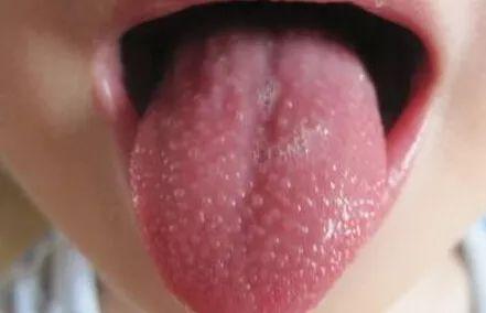 摸男朋友胸他起鸡皮疙瘩