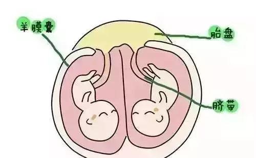 双胞胎在妈妈肚子里是什么的？是合住一起还是住单间？