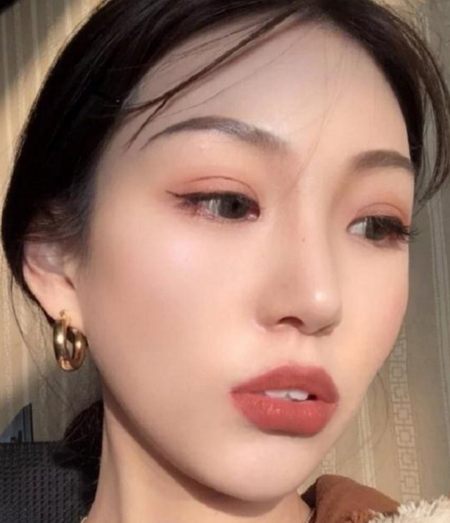想要做成高级脸，鼻综合：肋软骨隆鼻