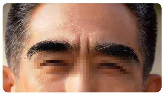 眉毛出-现这一个信-号,应该是大病预兆!万万得注重!