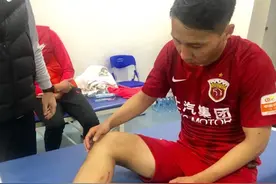 腿上三道伤痕是最好的军功章，张卫踢出今年最佳一战图片