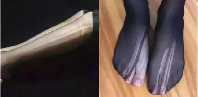 丝袜可以遮鸡皮肤吗