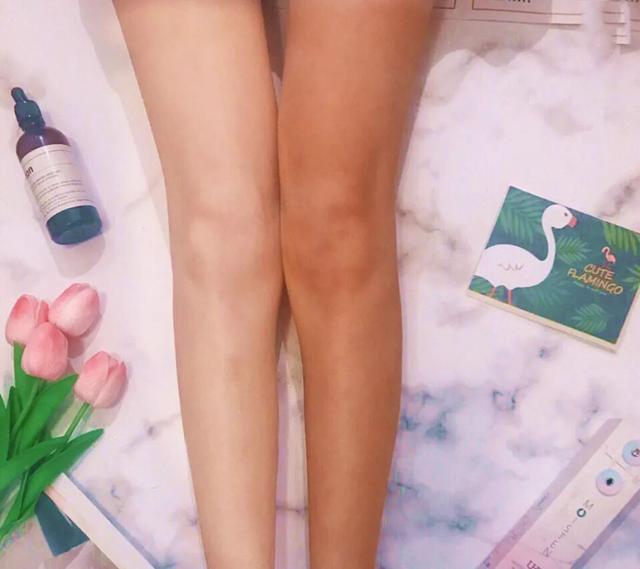 丝袜可以遮鸡皮肤吗
