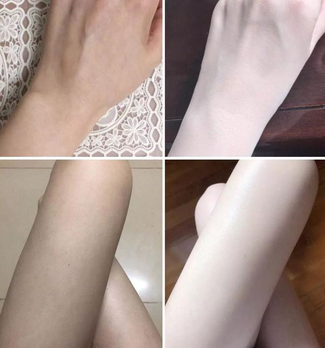 丝袜可以遮鸡皮肤吗