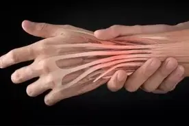 手腕疼？当心得了腱鞘炎！教你4招巧远离~图片