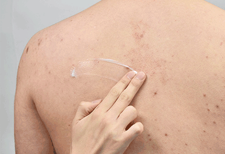 韩国没有鸡皮肤吗