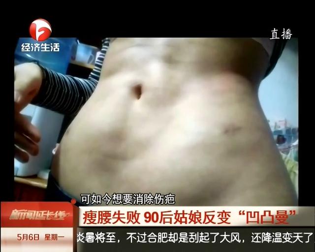 使小坑.的噩梦空间攻略（抽脂瘦腰失败）