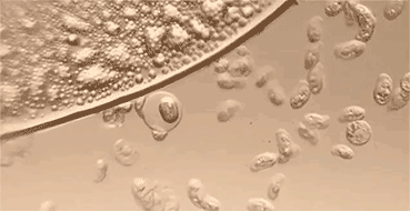 80%鐨勫绉戠柧鐥呴兘鍜屽唴瑁ゆ湁鍏筹紒铓曚笣鍐呰￥鍛婂埆涓嶉€? onerror=