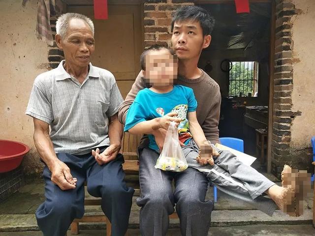 儿童掌跖角化病贴吧