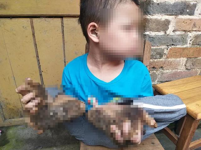 儿童掌跖角化病贴吧