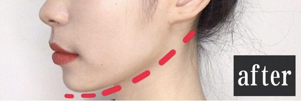 为什么身体乳用了发热