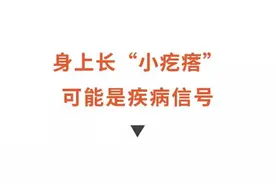 头皮、后背总长“小疙瘩”？小心，可能是疾病预警……图片
