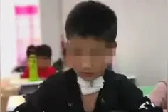 3岁时被藏獒咬断喉咙的男孩9岁了，如今有望过正常生活视频封面