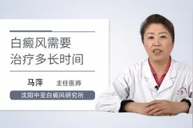 白癜风需要治疗多长时间