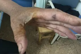 惊恐！砍断半小时的蛇头竟然还会咬人图片