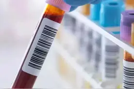 「提醒」癌症来之前都会有“癌前病变”！很多人没重视！图片