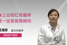 身上出现红斑瘙痒就一定是银屑病吗视频封面