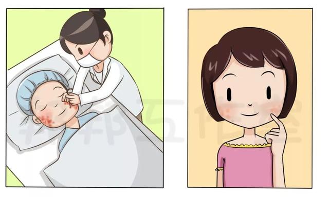 微针治皮肤角化