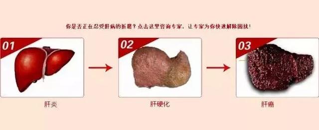 肝好命才好，抽烟喝酒每次吃几粒，100天还你“肝”净的肝脏