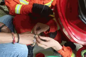 男子戴53枚戒指 导致多根手指变形发黑