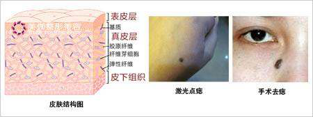 肽治疗皮肤病的案例 2026年肽调理皮肤病的案例