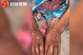 残忍！奶奶殴打7岁孙女体无完肤 警方：情法难容视频封面