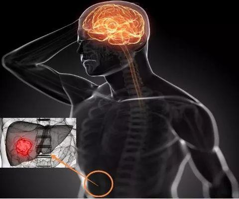 护肝，选择高支链氨基酸饮食