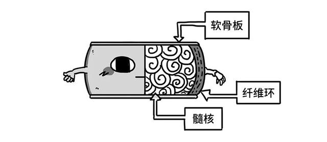 痛痛痛！3招帮你解决腰椎间盘突出