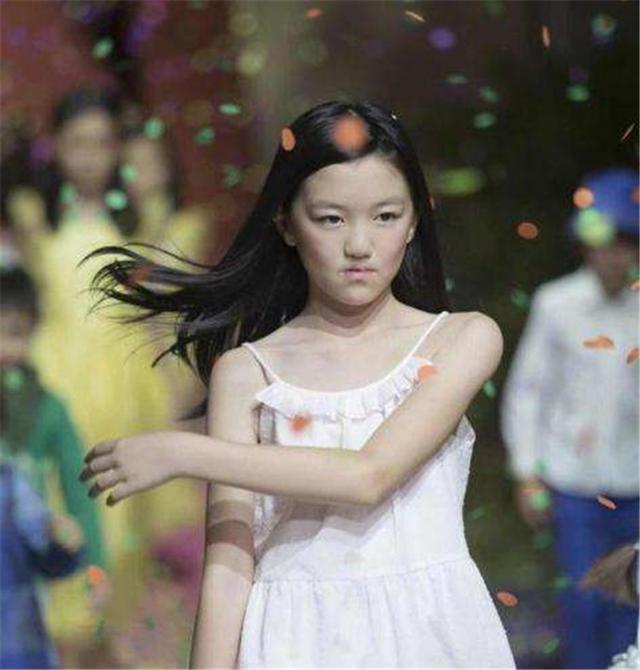 王菲女儿李嫣兔唇原因是什么（李嫣的兔唇是遗传吗 李嫣的兔唇前后照片对比令人心疼）