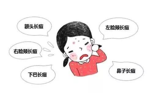 皮脂腺管角化是什么意思