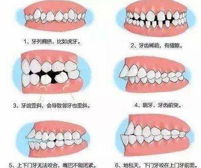 做牙齿矫正最佳年龄是多少岁？长大后还能矫正好吗？