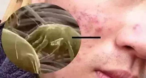 蚕丝被被曝光了！被子盖的不对，对身体有哪些危害，不知道的赶紧看看...