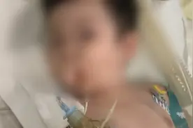 第四次住院了！1岁男孩误吞纽扣电池，高额治疗费压垮整个家庭！视频封面
