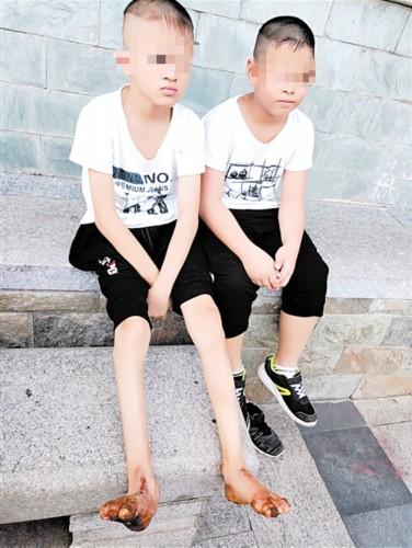 角化症能治得好吗