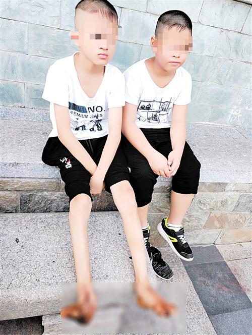 那里治疗皮肤角化症