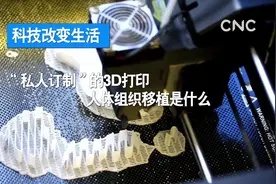 科技改变生活| “私人订制”的3D打印人体组织移植是什么视频封面