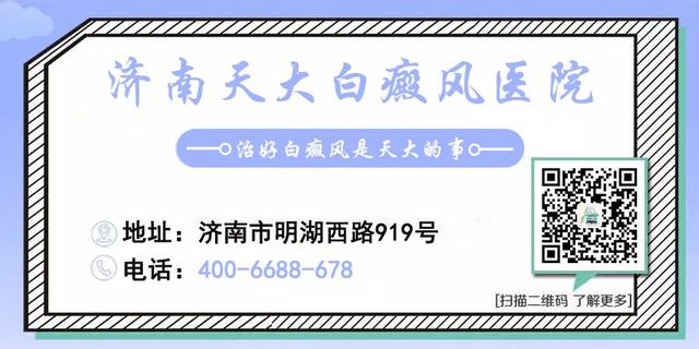 白癜风的症状有哪些？这四个颜色暗示一定要知道