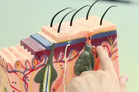 人为什么会变黑？美白原理有哪些？皮肤科医生给你答案