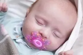 【心痛】中山1岁多宝宝身上大量瘀斑，竟是奶奶捏的！这些偏方太坑人了！图片