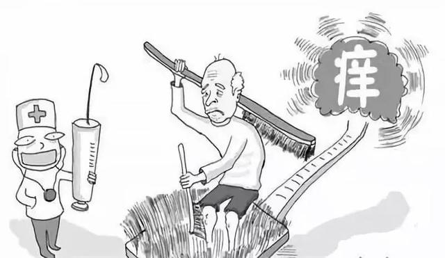 “人工性”荨麻疹是怎么回事？