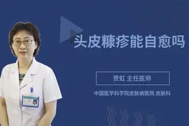 头皮糠疹能自愈吗