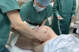 1分钟剖宫产变顺产！广州这个医生产房变“魔术”，孕妇免挨一刀视频封面