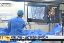 癌症患者的生命奇迹！碘粒子植入，胃癌晚期病人活了13年！视频封面