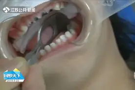 4岁女孩坏掉16颗乳牙,“全麻”进了手术室,因从小养成这个习惯视频封面
