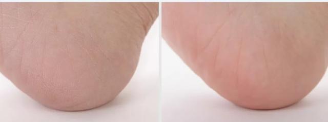 学生党平价绵羊油身体乳