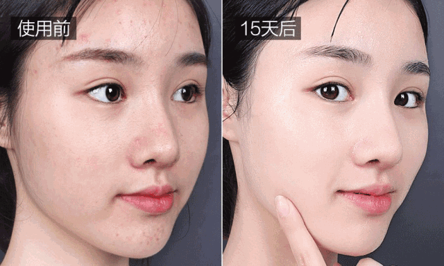 经常喝胶原蛋白有什么副作用 2026年经常喝胶原蛋白有什么副作用和危害